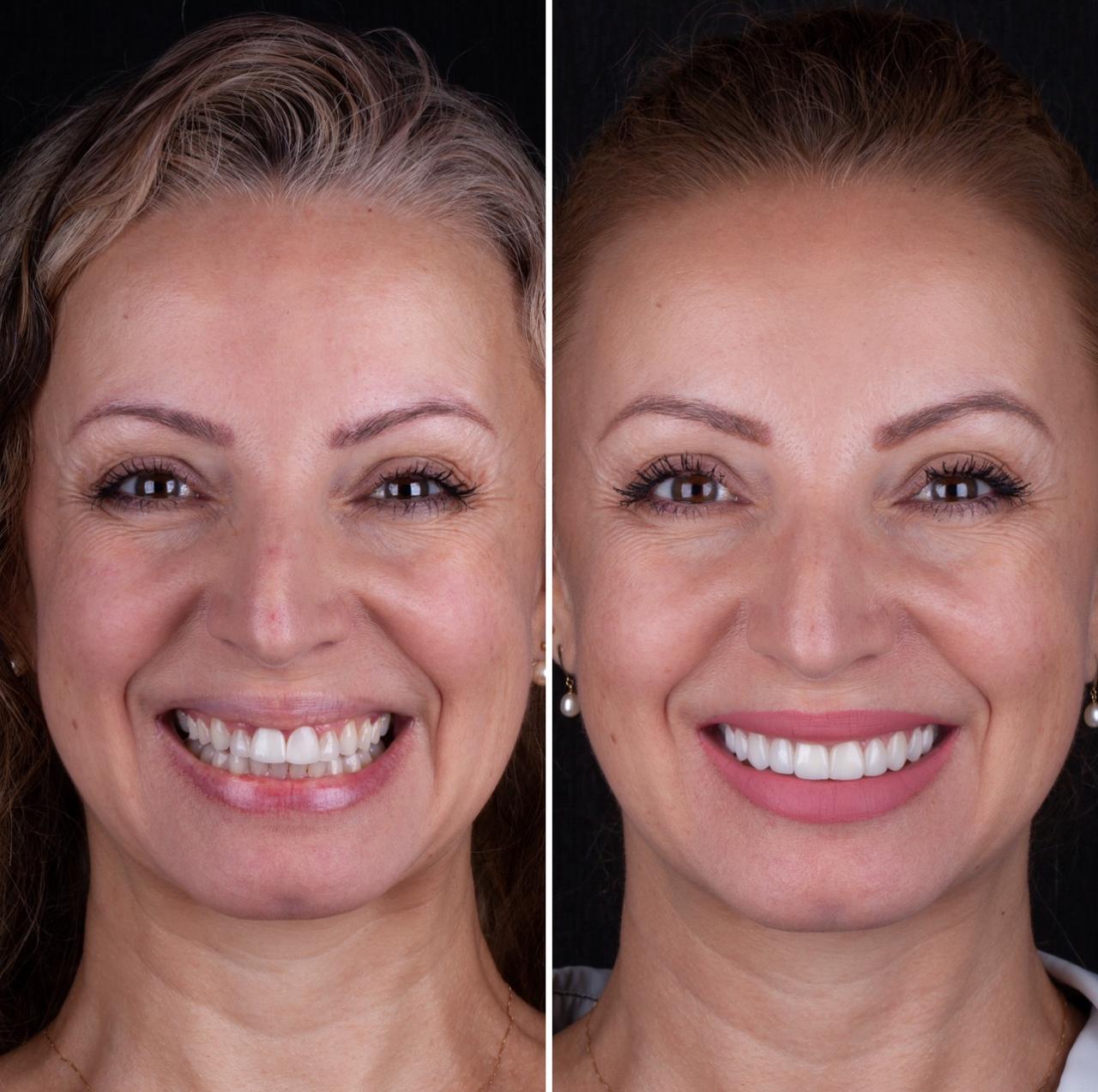 WhatsApp Image 2025-07-04 at 09.09.32-7